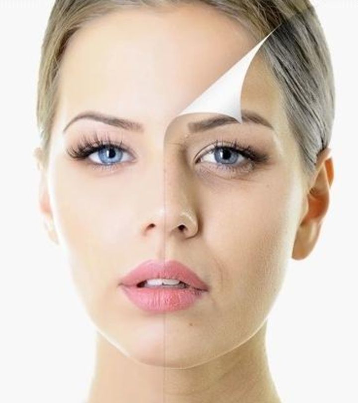 Factors That Determine the Cost of a Facelift