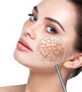 home-remedies-for-dry-skin