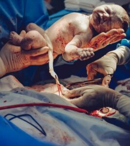 common-birth-injuries