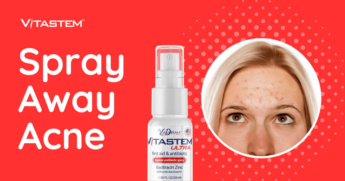 Spray Away Acne Fast with Vitastem Ultra: A Topical Antibiotic Like Nothing Else